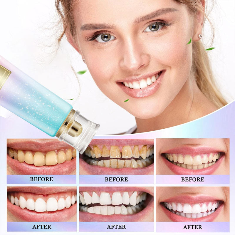 Teeth whitening toothpaste