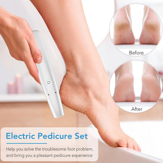 ⏳Limited Time Sale 75% off🔥Electric callus remover for fee